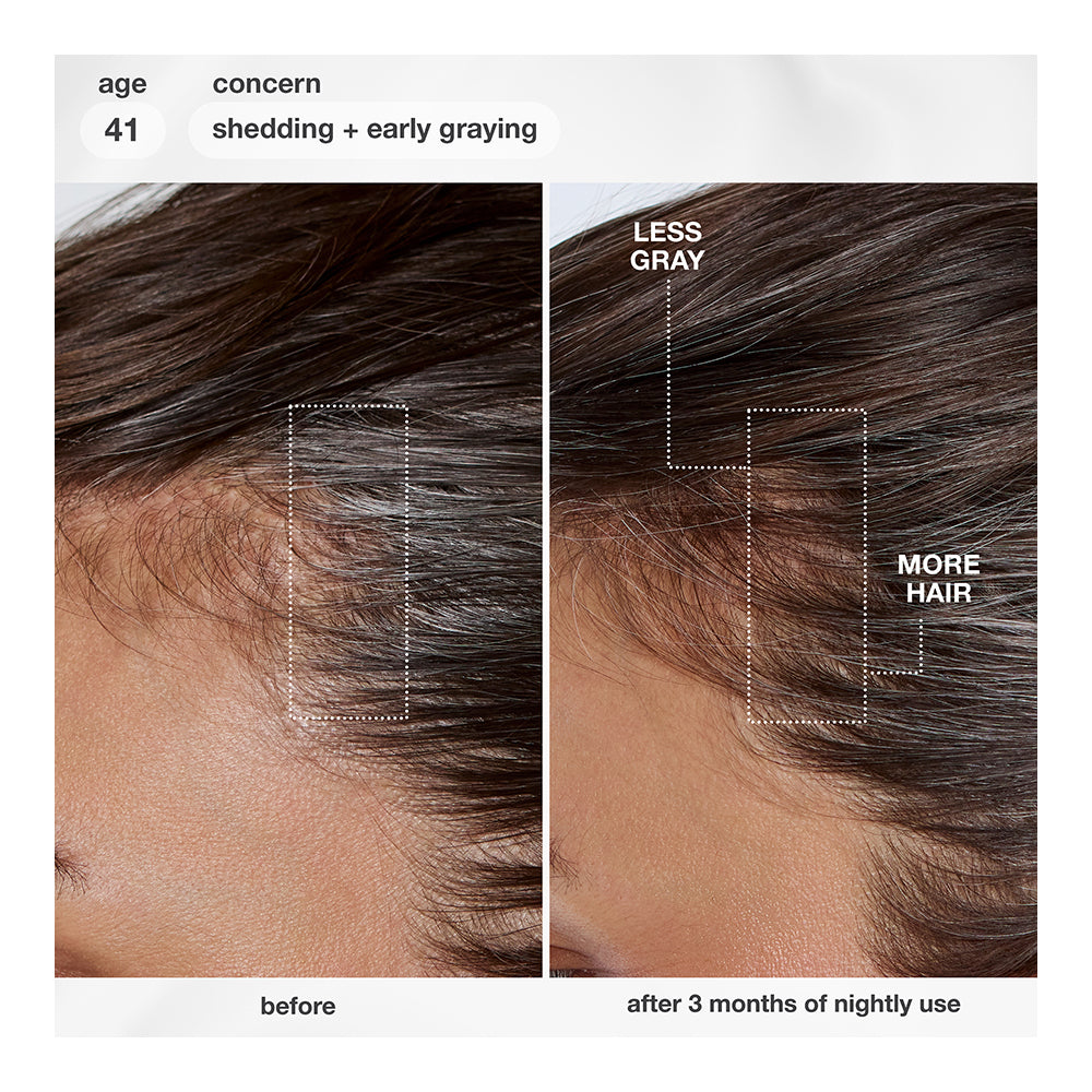 FutureIQ™ biomimetic hair longevity serum