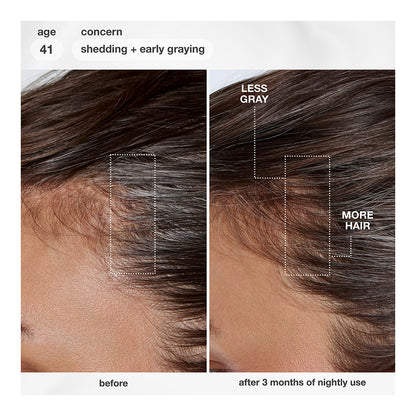 FutureIQ™ biomimetic hair longevity serum