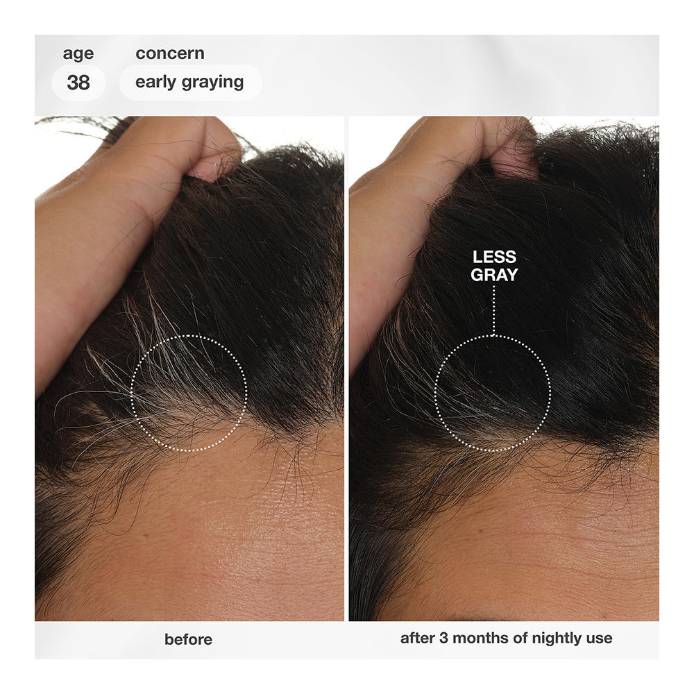 FutureIQ™ biomimetic hair longevity serum