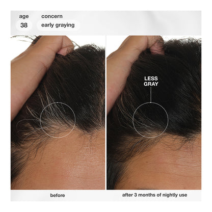 FutureIQ™ biomimetic hair longevity serum