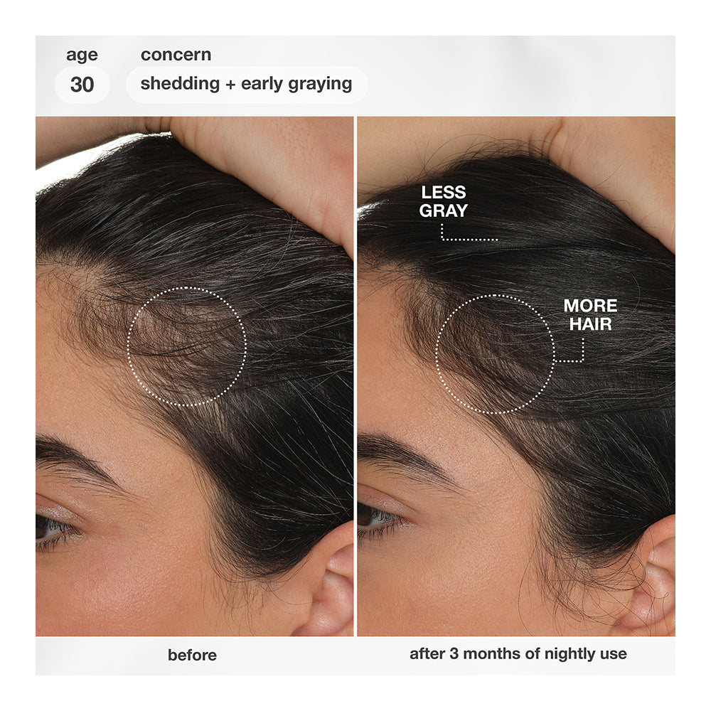 FutureIQ™ biomimetic hair longevity serum