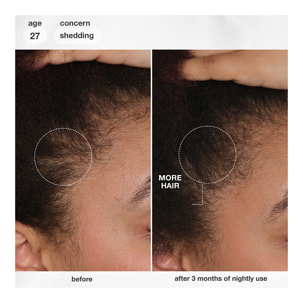 FutureIQ™ biomimetic hair longevity serum