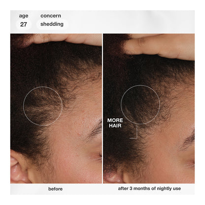 FutureIQ™ biomimetic hair longevity serum