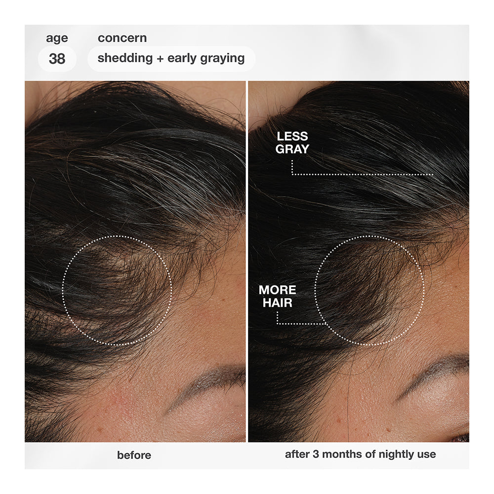 FutureIQ™ biomimetic hair longevity serum